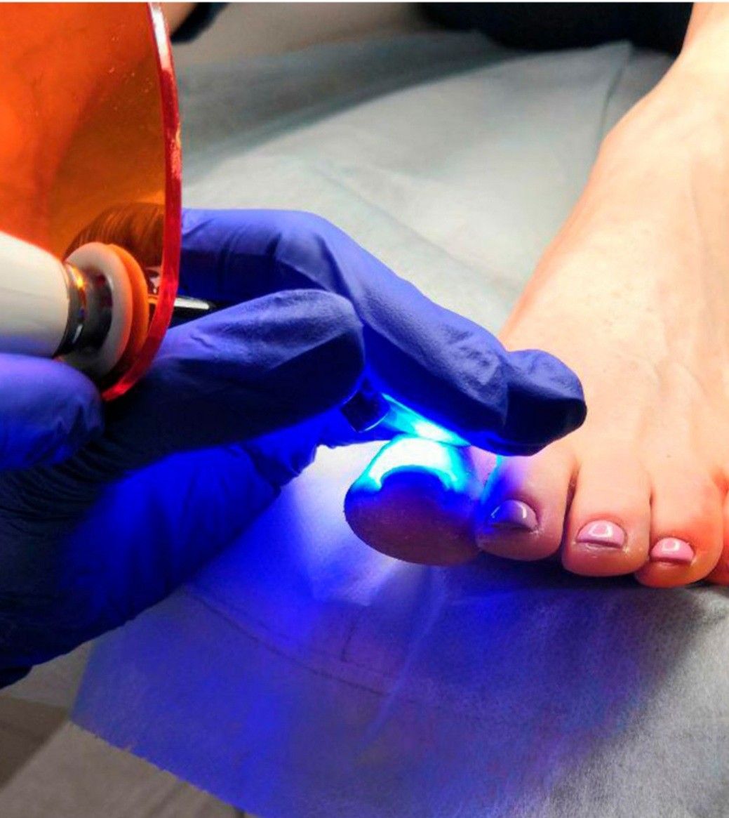 Pedicure Clínico en CDMX - Podología Clínica CDMX