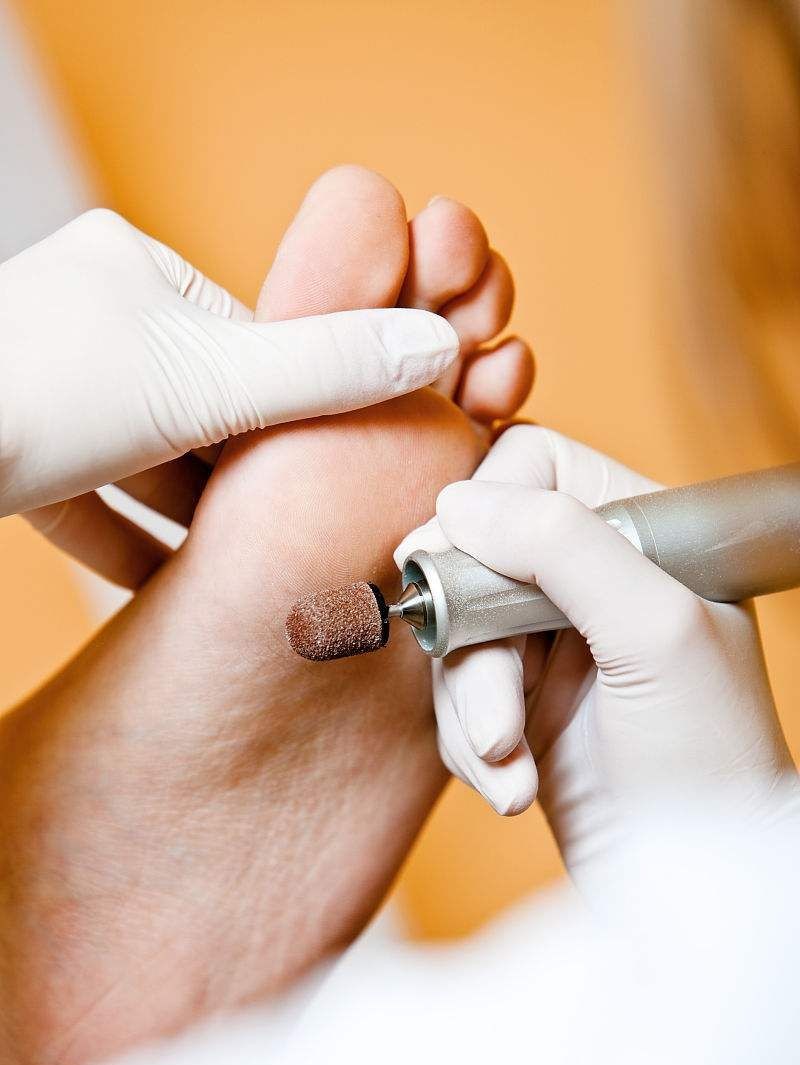 Tratamiento Pie Diabético en CDMX - Podología Clínica CDMX
