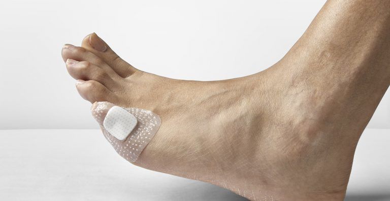 Curaciones Especializadas Pies en CDMX - Podología Clínica